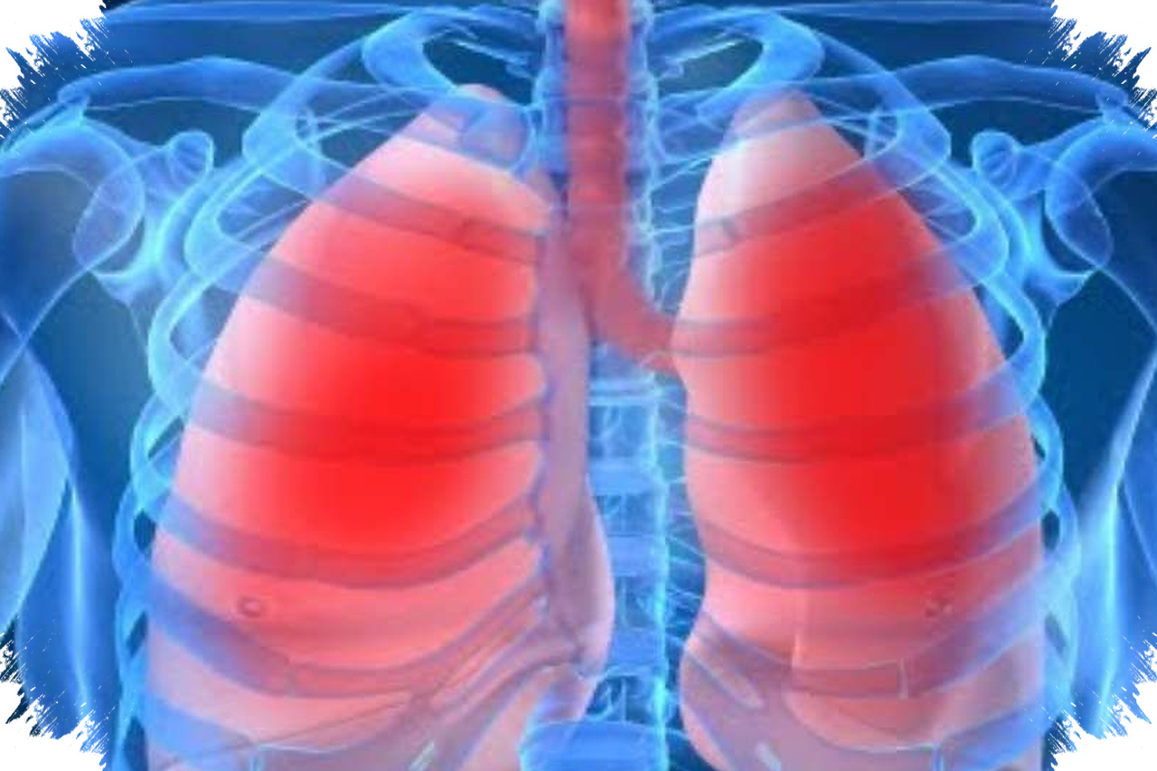 Napas Cepat Dan Batuk Pada Anak Bisa Tanda Pneumonia, Jangan Tunggu Sampai Sesak