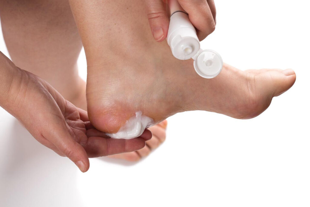 Perawatan Kaki Pecah-Pecah Jadi Lebih Praktis, 5 Foot Cream Ini Bantu Tumit Lebih Halus