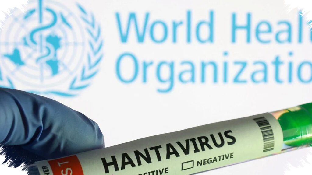 Hasil Laboratorium Menyatakan Negatif, Kulon Progo Tak Catat Kasus Hantavirus Pada Manusia