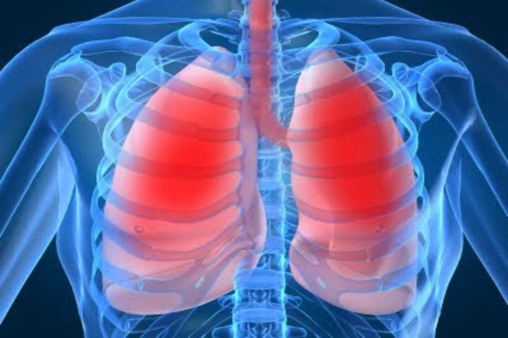 Bisa Membekukan Tumor Paru Saat Operasi Tak Bisa Dilakukan, Lung Cryoablation Lebih Minim Nyeri