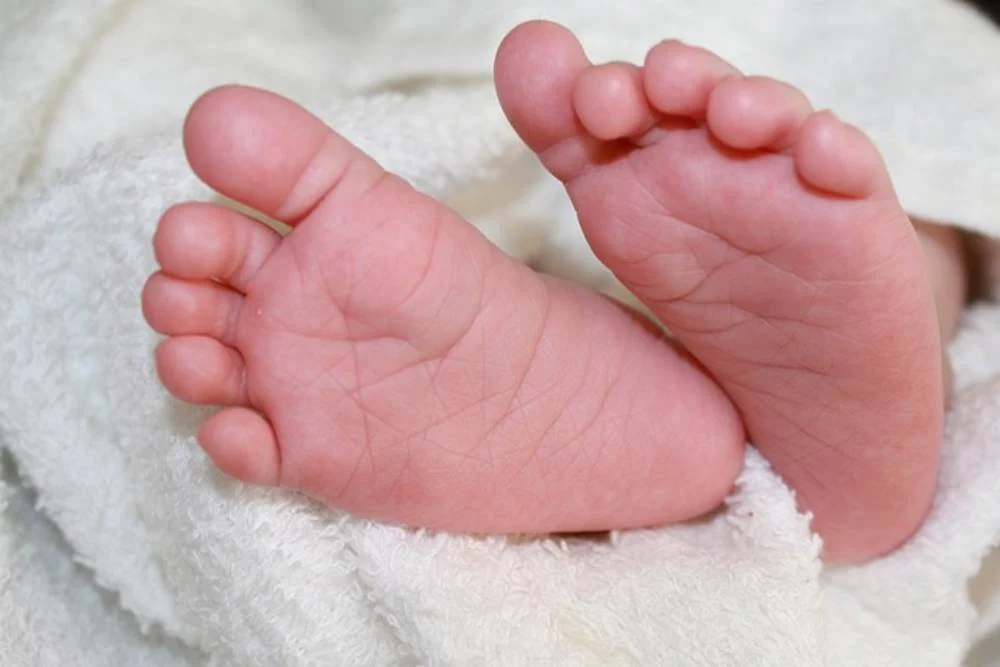Gumoh Pada Bayi Tidak Selalu Berbahaya, Ini Tanda yang Harus Diwaspadai