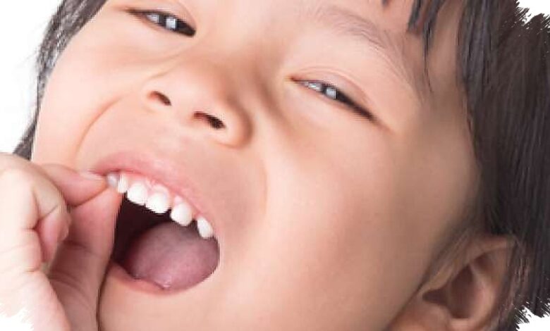Gigi Berlubang Bisa Ganggu Nafsu Makan Anak, Pemeriksaan Rutin Jadi Kunci