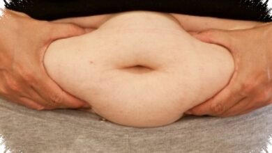 Obesitas Bukan Sekadar Gemuk, Risiko Jantung dan Kanker Mengintai