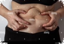 Kulit Tidak Perlu Sempurna, Skin Positivity Menuntun Orang Fokus pada Perawatan Dasar