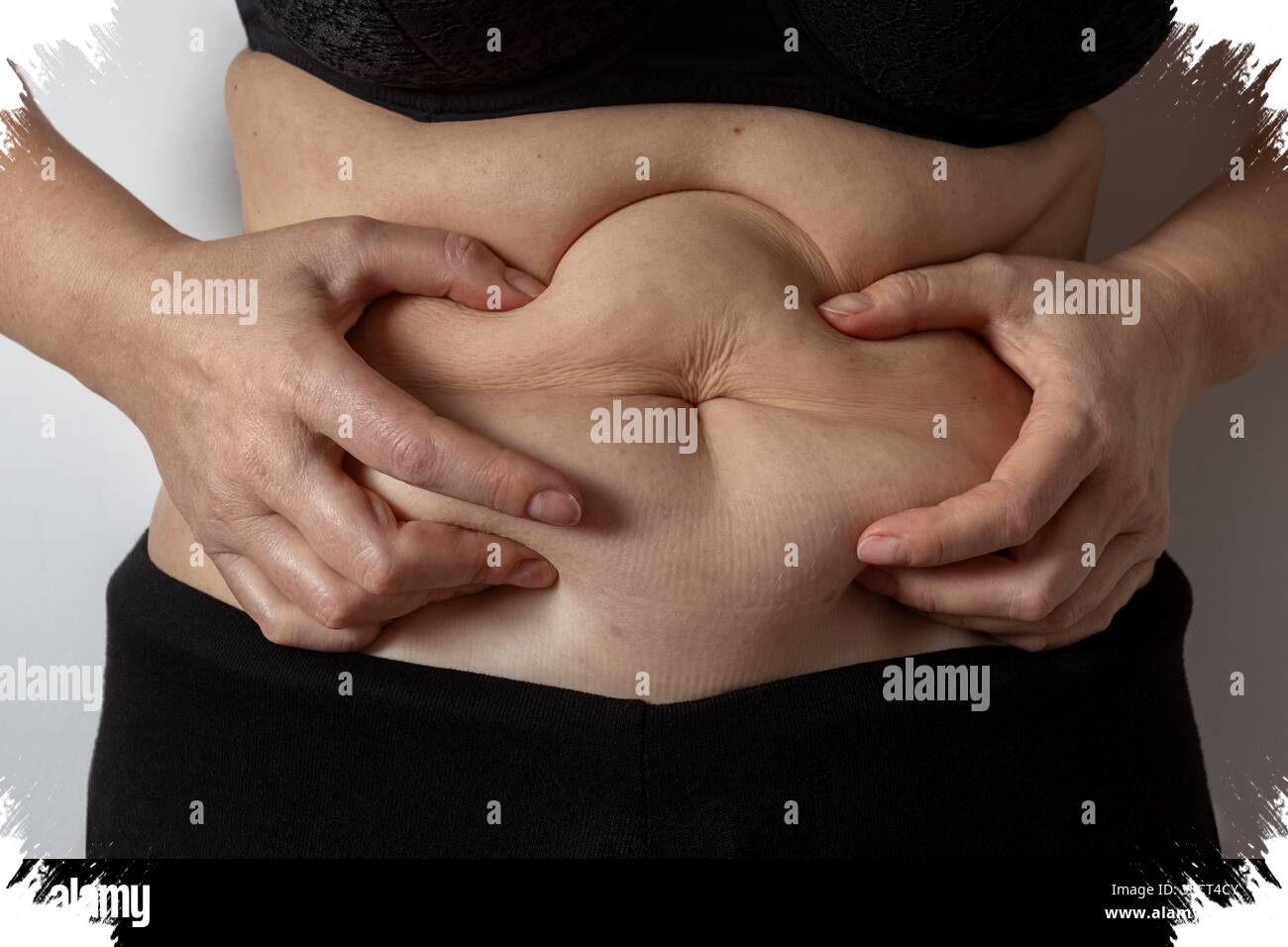 Kulit Tidak Perlu Sempurna, Skin Positivity Menuntun Orang Fokus pada Perawatan Dasar