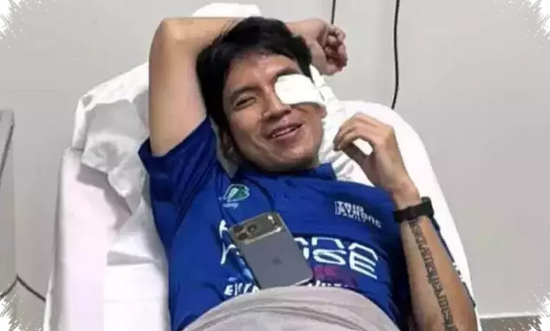 Mata Kiri Desta Cedera di FIP Jakarta, Pendarahan Disebut Sampai Lensa Mata