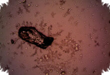 Wabah Cyclospora di Michigan Tembus 1.000 Kasus, Sumber Penularannya Masih Dicari