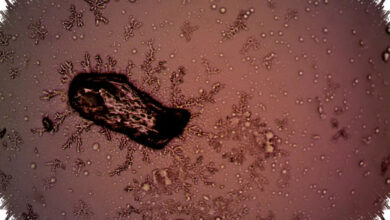 Wabah Cyclospora di Michigan Tembus 1.000 Kasus, Sumber Penularannya Masih Dicari