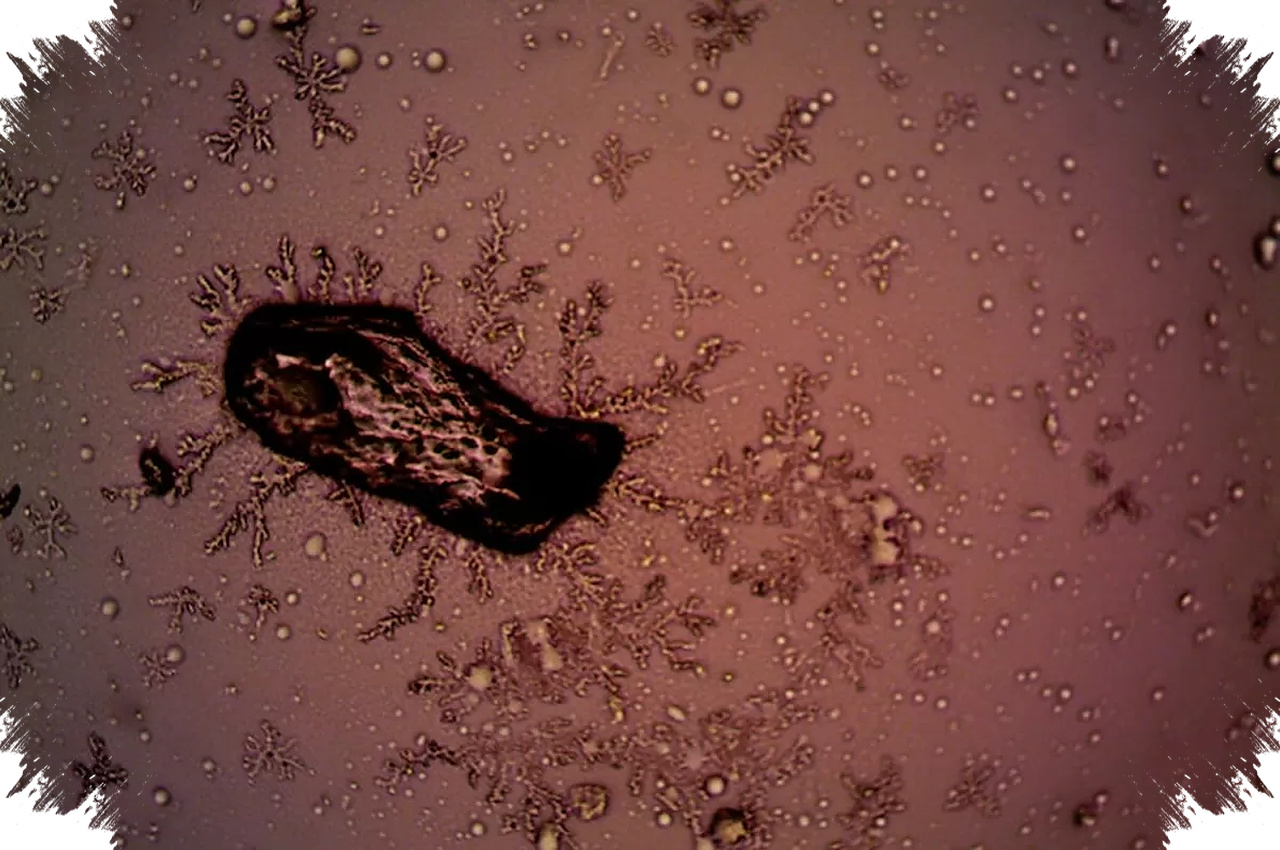 Wabah Cyclospora di Michigan Tembus 1.000 Kasus, Sumber Penularannya Masih Dicari