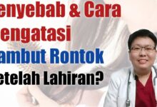 Rambut Rontok Usai Melahirkan Ternyata Umum, Ini Tanda yang Perlu Diwaspadai