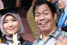 Temon Tiba-Tiba Mengeluh Dada Kiri Sakit, Beberapa Jam Sebelumnya Masih Bercanda