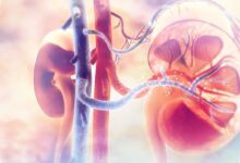 7 Kebiasaan yang Diam-diam Bisa Merusak Ginjal, Obat Bebas Bukan Satu-satunya Pemicu