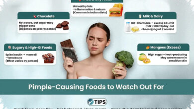 7 Makanan yang Sering Dianggap Sehat, Ternyata Bisa Memperparah Jerawat