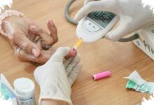 Karies Gigi Menimpa Lebih dari 40% Anak, Sinyal Risiko yang Melampaui Anemia