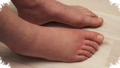 8 Sinyal Tubuh Kelebihan Garam, Bengkak dan Jantung Berdebar Perlu Diwaspadai