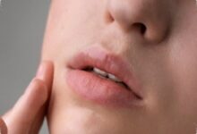 Bibir Makin Kering Seusai Lip Balm, 4 Kandungan yang Patut Diperiksa