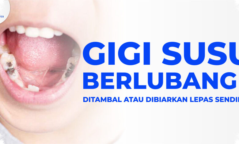 Gigi Susu Berlubang Bisa Mengacaukan Pertumbuhan Gigi Permanen Anak