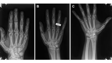 Rontgen Portabel Berhasil Dipakai di Orbit, Diagnosis Astronaut Kini Lebih Dekat