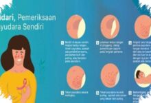 Kanker yang Sama Tak Selalu Butuh Obat Sama, Terapi Presisi Buka Harapan Baru