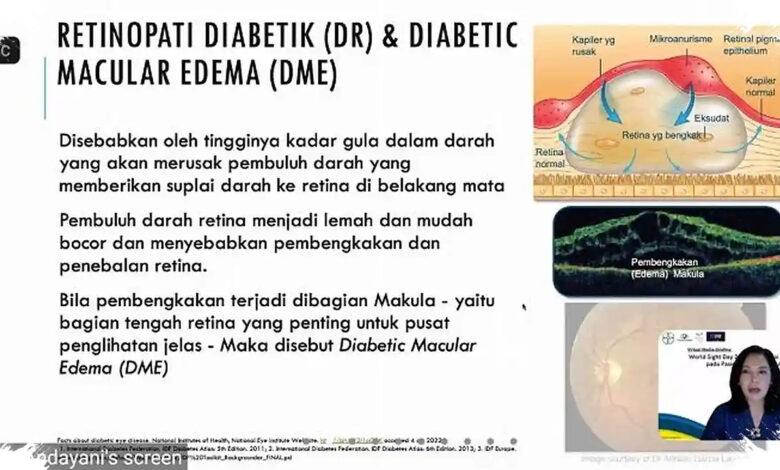 Kebutaan akibat Diabetes Bisa Dicegah, Namun Skrining Mata Sering Terlambat