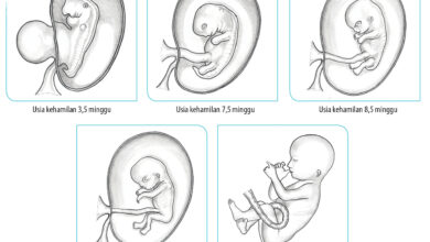 Risiko Jantung Bawaan Naik hingga 7 Persen bila Ibu Memiliki Riwayat Serupa